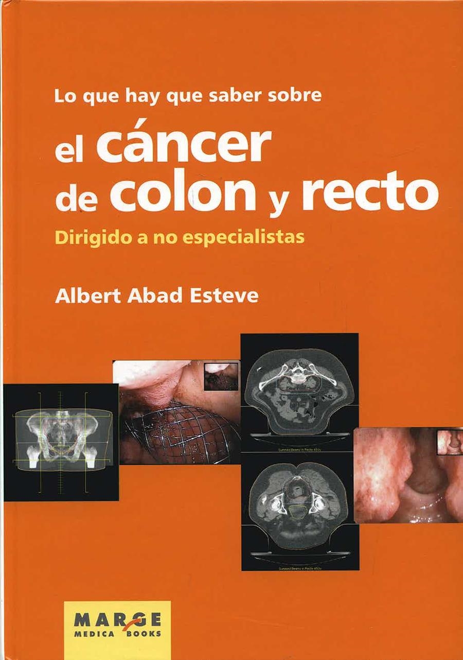 LO QUE HAY QUE SABER SOBRE EL CÁNCER DE COLON Y RECTO | 9788492442546 | ABAD ESTEVE, ALBERT